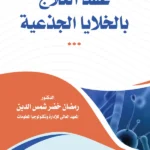 عقد العلاج بالخلايا الجذعية